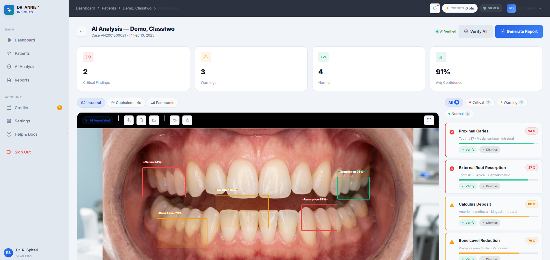 Annie Insight AI Diagnostic Suite
